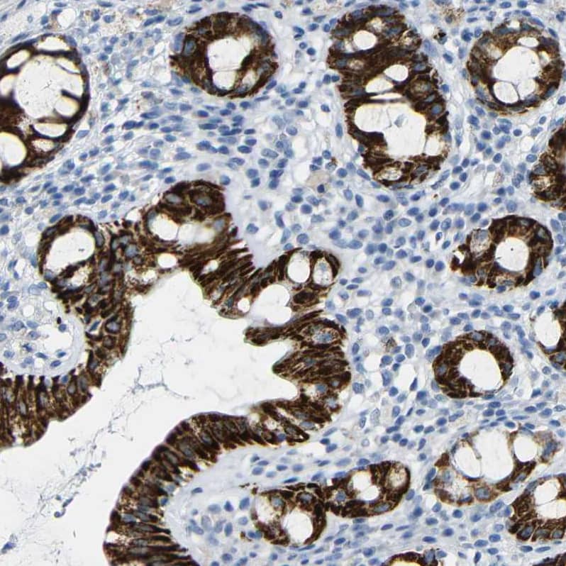 Immunohistochemistry-Paraffin NMES1 Antibody