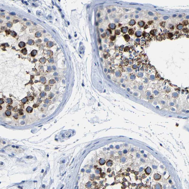 Immunohistochemistry-Paraffin NMES1 Antibody
