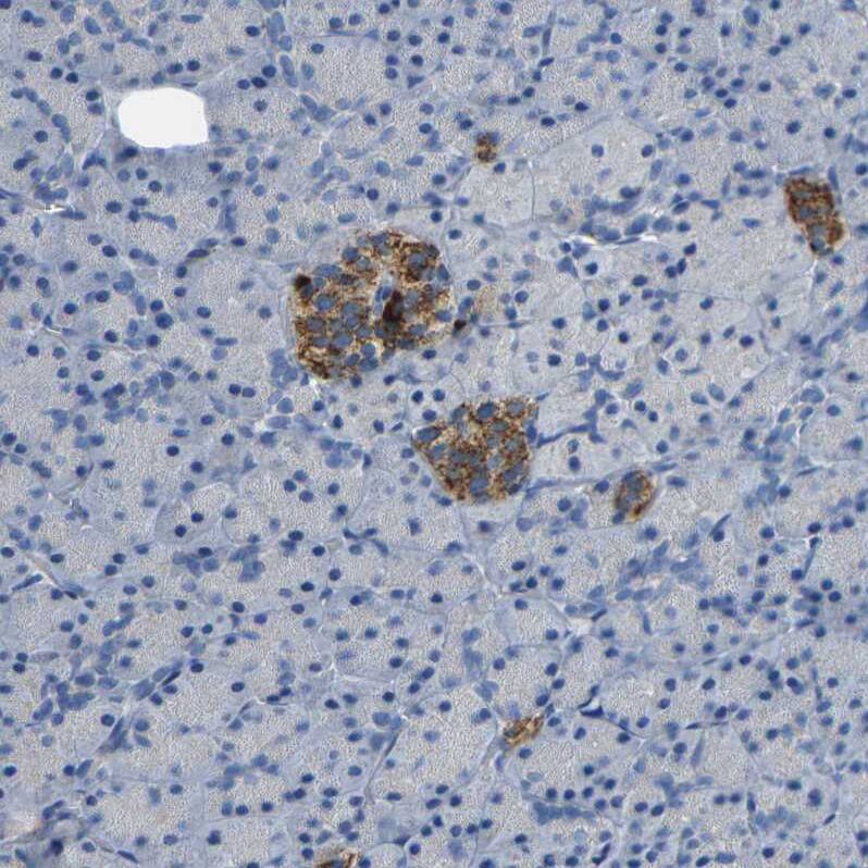 Immunohistochemistry-Paraffin NMES1 Antibody