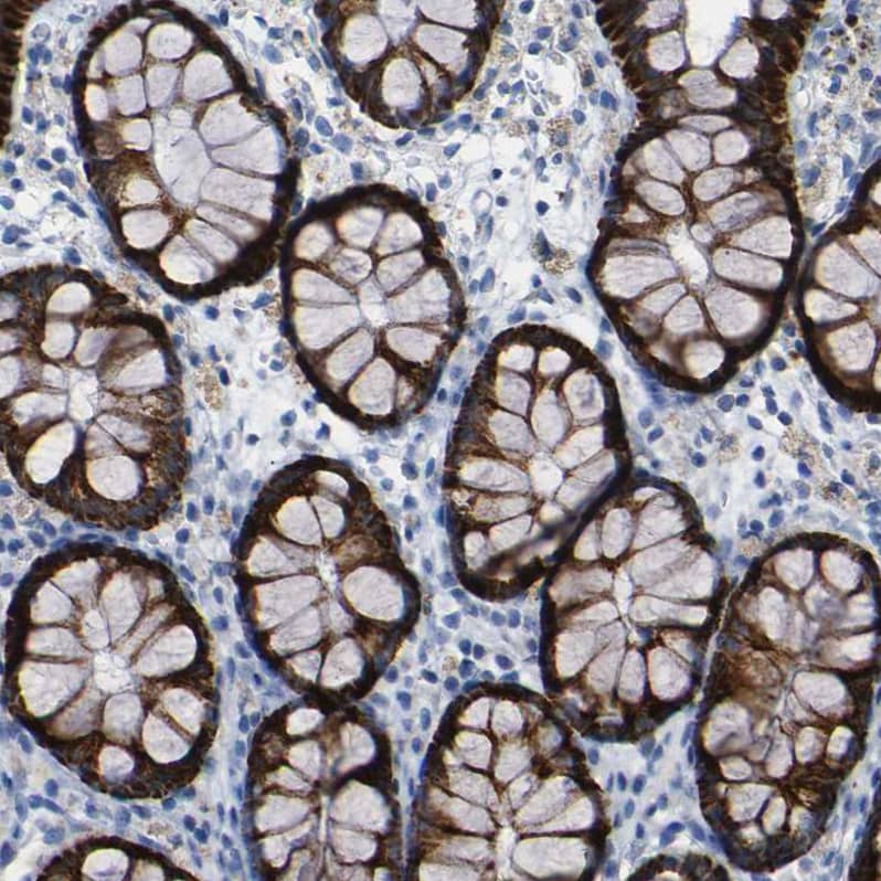 Immunohistochemistry-Paraffin NMES1 Antibody