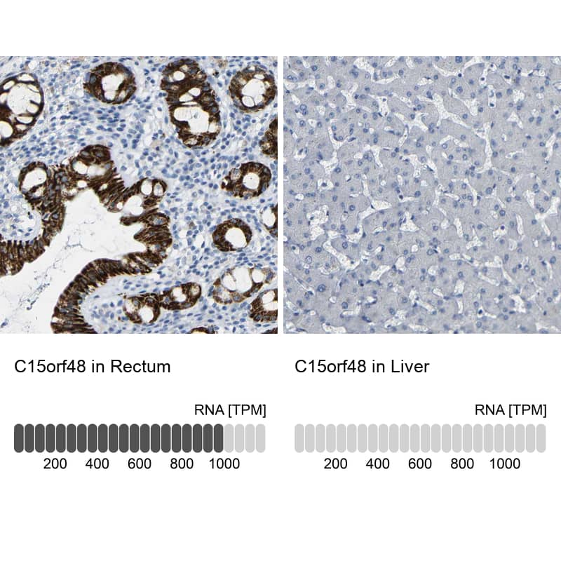 Immunohistochemistry-Paraffin NMES1 Antibody