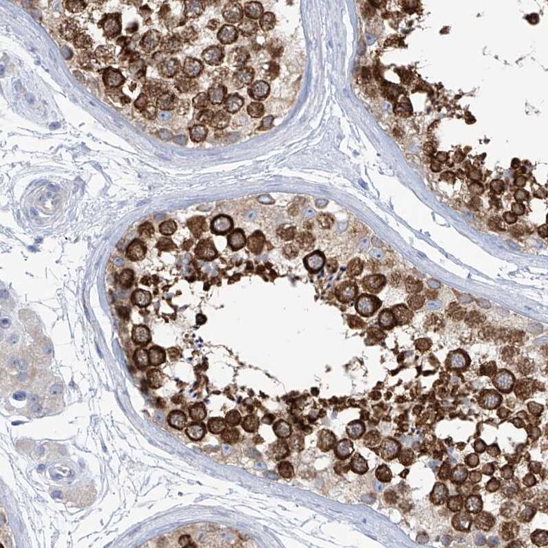 Staining of human testis shows strong cytoplasmic positivity in cells in seminiferous ducts.