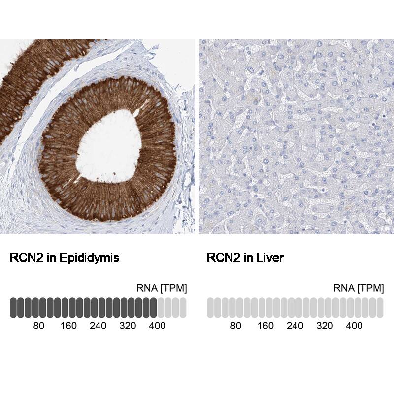 <b>Orthogonal Strategies Validation. </b>Analysis in human epididymis and liver tissues. Corresponding RNA-seq data are presented for the same tissues.