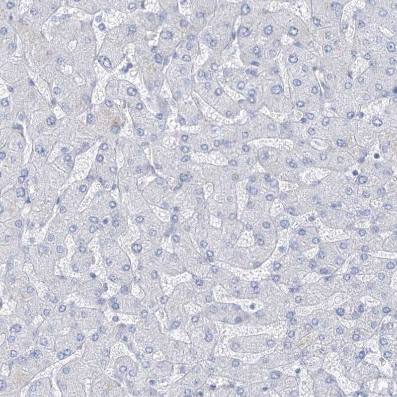 Staining of human liver shows no positivity in hepatocytes as expected.