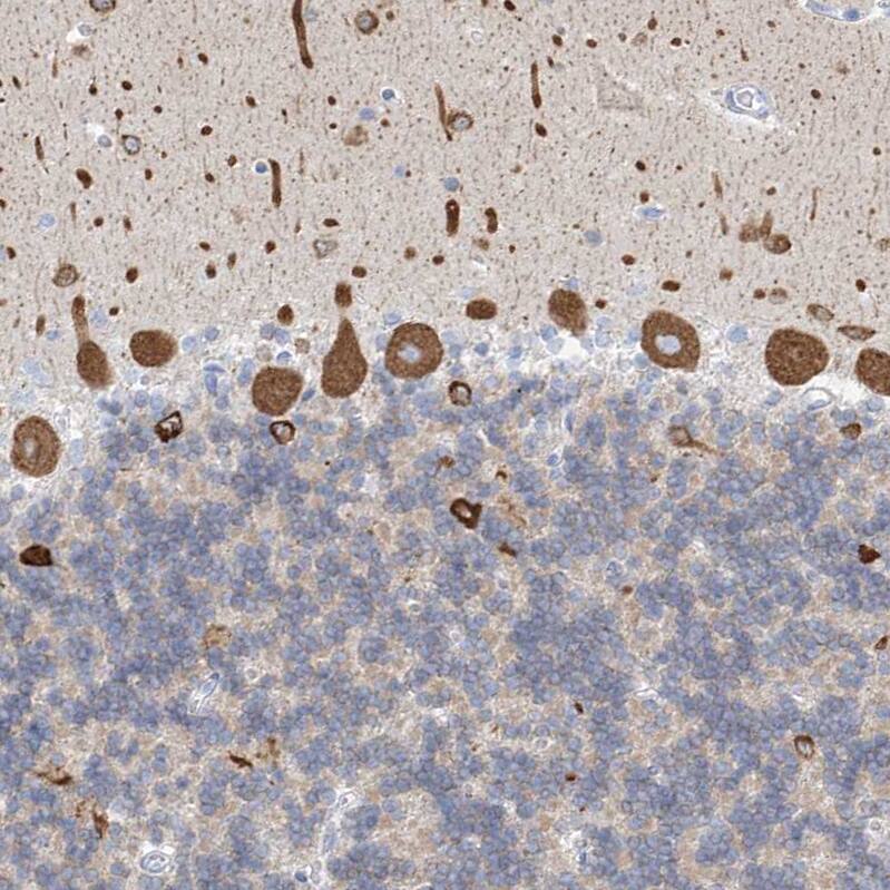 Staining of human cerebellum shows strong cytoplasmic positivity in Purkinje cells.