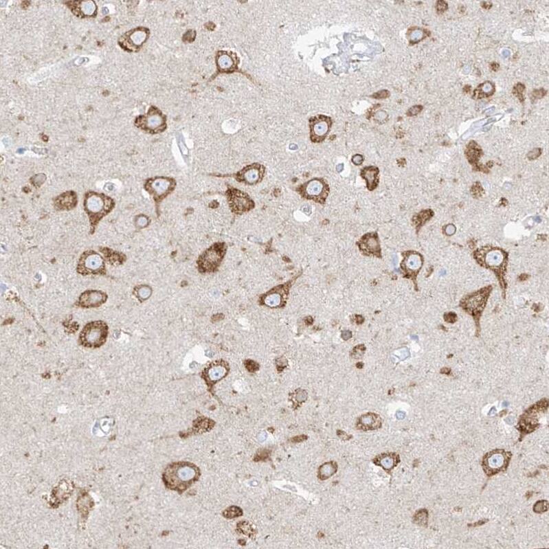 Staining of human cerebral cortex shows strong cytoplasmic positivity in neurons.