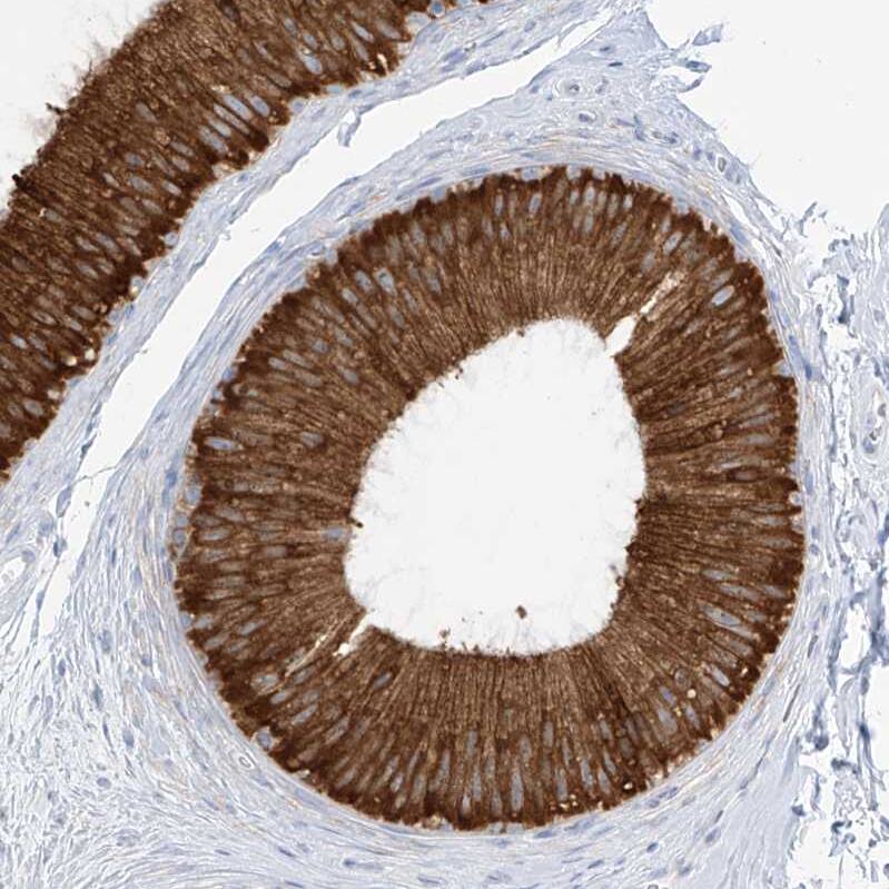 Staining of human epididymis shows strong cytoplasmic positivity in glandular cells.