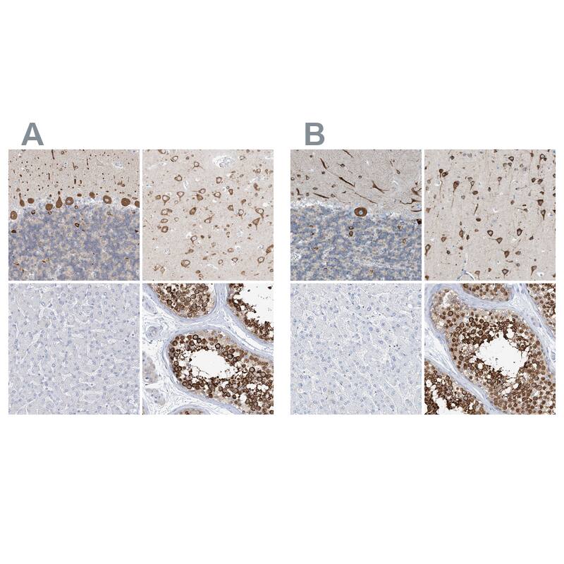 <b>Orthogonal Strategies Validation. </b>Staining of human cerebellum, cerebral cortex, liver and testis HPA030694 (A) shows similar protein distribution across tissues to independent antibody HPA030695 (B).