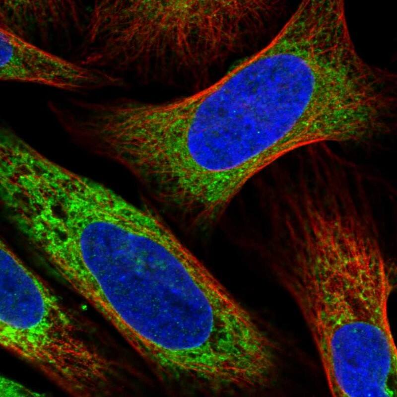 Staining of human cell line U-2 OS shows localization to endoplasmic reticulum.
