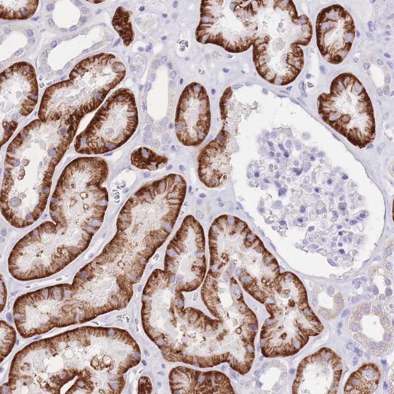 Immunohistochemistry-Paraffin SLC4A4 Antibody - BSA Free