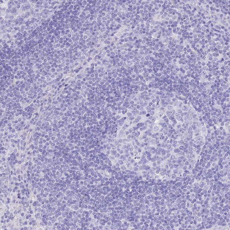 Immunohistochemistry-Paraffin SLC4A4 Antibody - BSA Free
