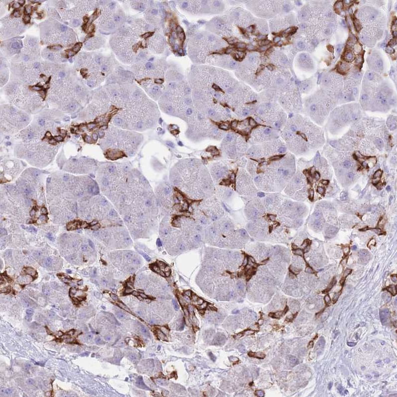 Staining of human pancreas shows strong membranous positivity in intercalated ducts.