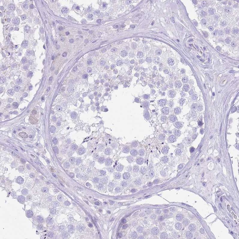 Immunohistochemistry-Paraffin SLC4A4 Antibody - BSA Free