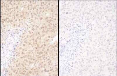 <b>Independent Antibodies Validation. </b>Samples: FFPE serial sections of mouse renal cell carcinoma. Antibody: Affinity purified rabbit anti- WWOX (NBP2-32121 left; NBP2-32122 right) used at a dilution of 1:1,000 (1ug/ml). Detection: DAB. Counterstain: Hematoxylin (blue).
