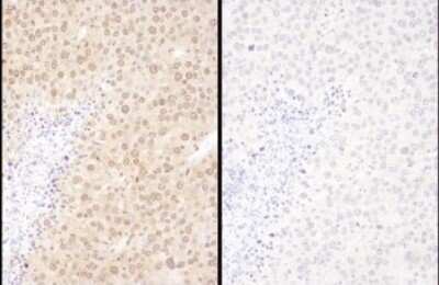 <b>Biological Strategies Validation. </b>Samples: FFPE serial sections of mouse renal cell carcinoma. Antibody: Affinity purified rabbit anti- WWOX (NBP2-32121 left; NBP2-32122 right) used at a dilution of 1:1,000 (1ug/ml). Detection: DAB. Counterstain: Hematoxylin (blue).