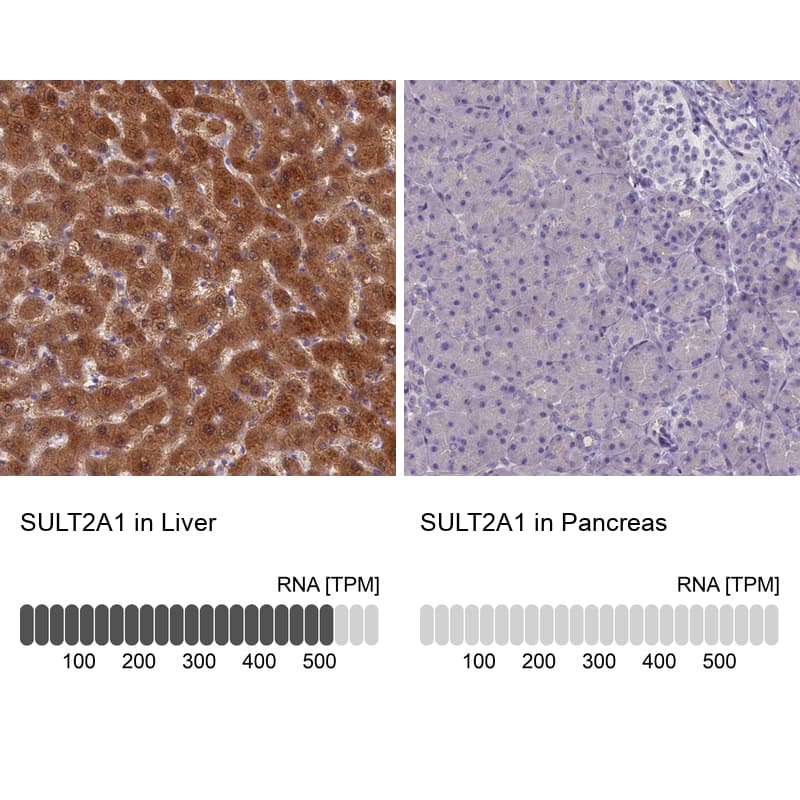 Immunohistochemistry-Paraffin Cytosolic Sulfotransferase 2A1/SULT2A1 Antibody - BSA Free