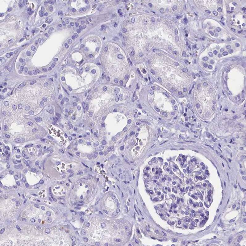 Staining of human kidney shows no positivity in cells in tubules as expected.