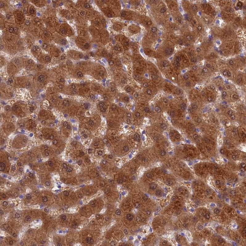 Staining of human liver shows strong cytoplasmic positivity in hepatocytes.