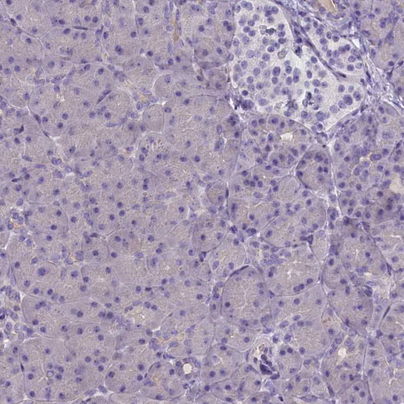 Staining of human pancreas shows no positivity in exocrine glandular cells as expected.