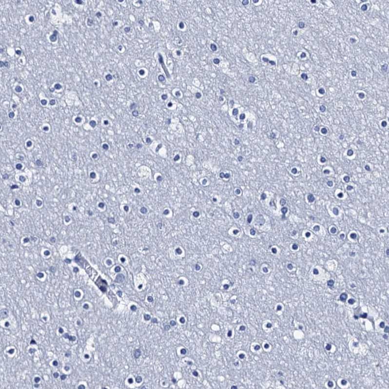 Staining of human cerebral cortex shows no positivity in neurons as expected.