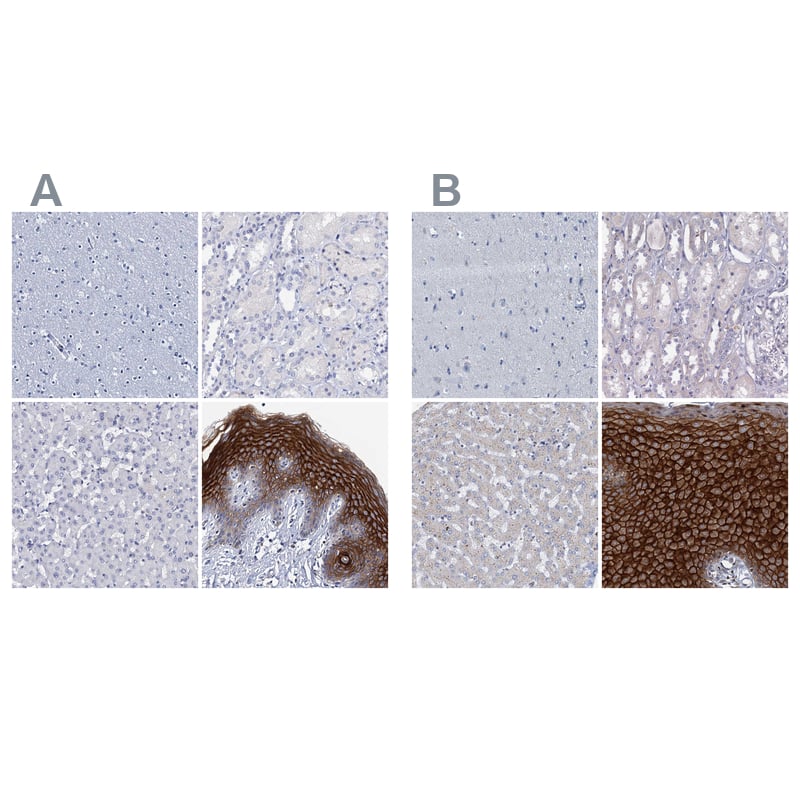 Staining of human cerebral cortex, kidney, liver and skin .