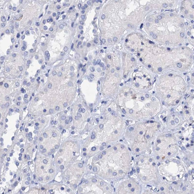Staining of human kidney shows no positivity in cells in tubules as expected.