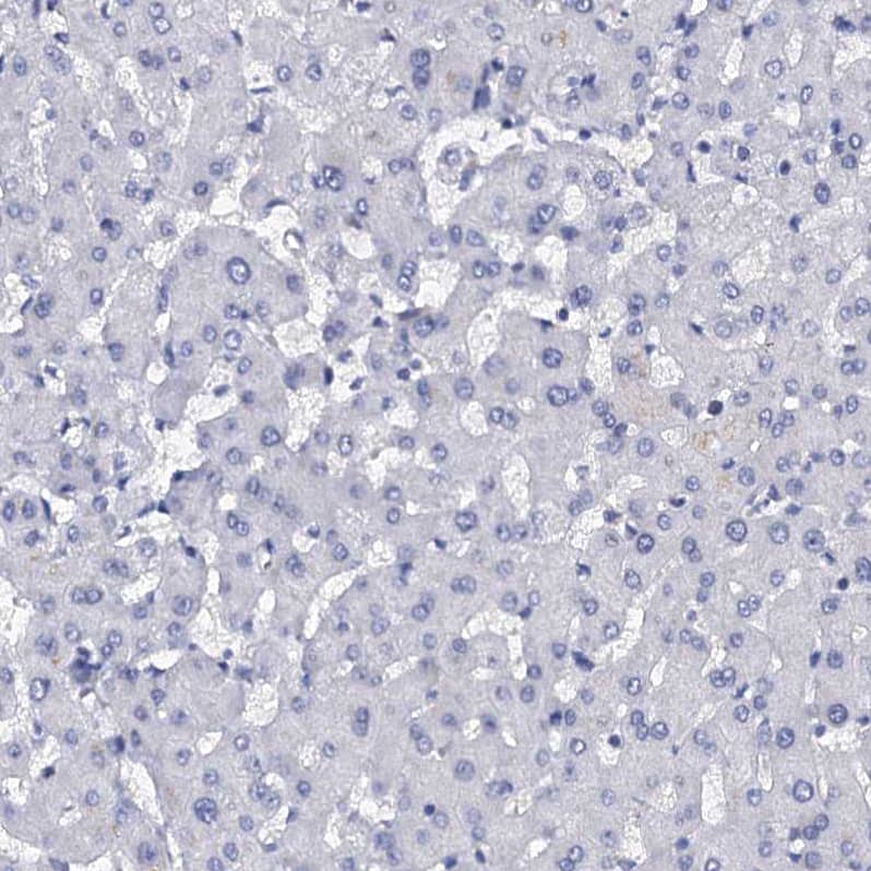 Staining of human liver shows no positivity in hepatocytes as expected.
