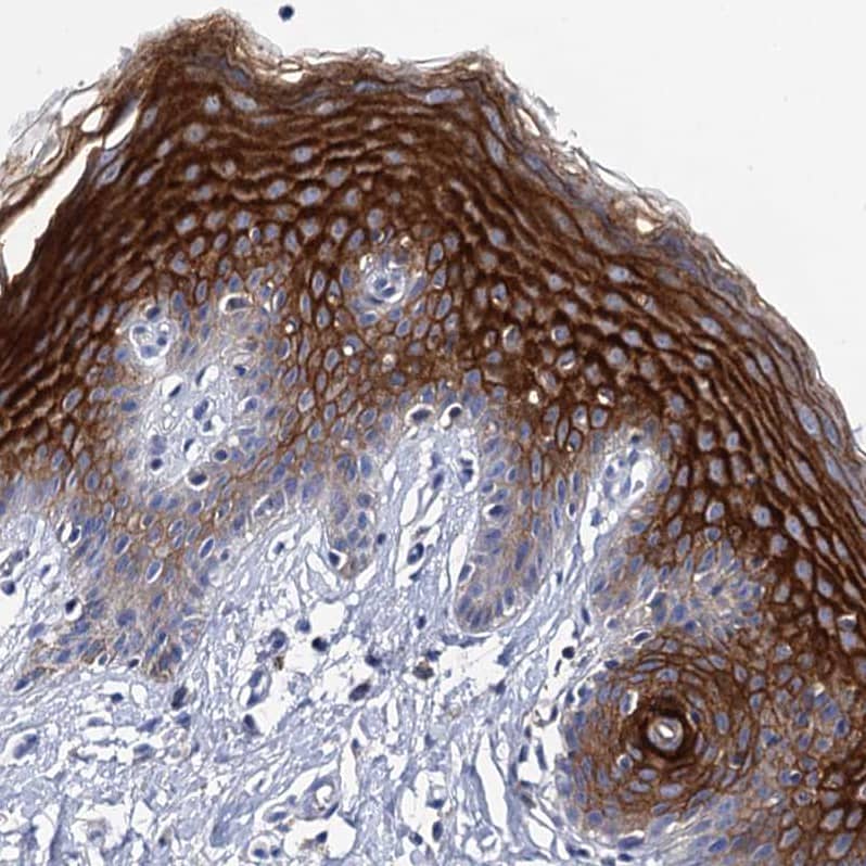 Staining of human skin shows strong membranous positivity in squamous epithelial cells.