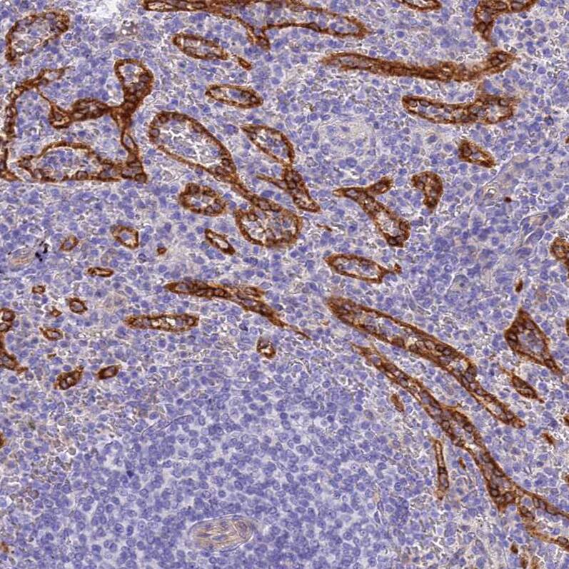 Staining of human spleen shows strong cytoplasmic positivity in red pulp.
