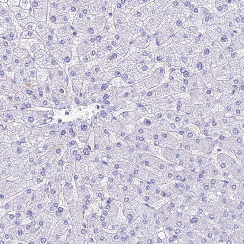 Staining of human liver shows no positivity in hepatocytes.