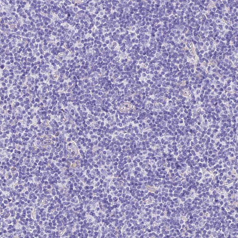 Staining of human lymphoid tissues shows no positivity in non-germinal center cells.