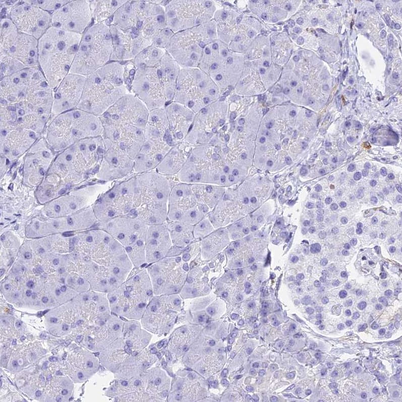 Staining of human pancreas shows no positivity in exocrine glandular cells.