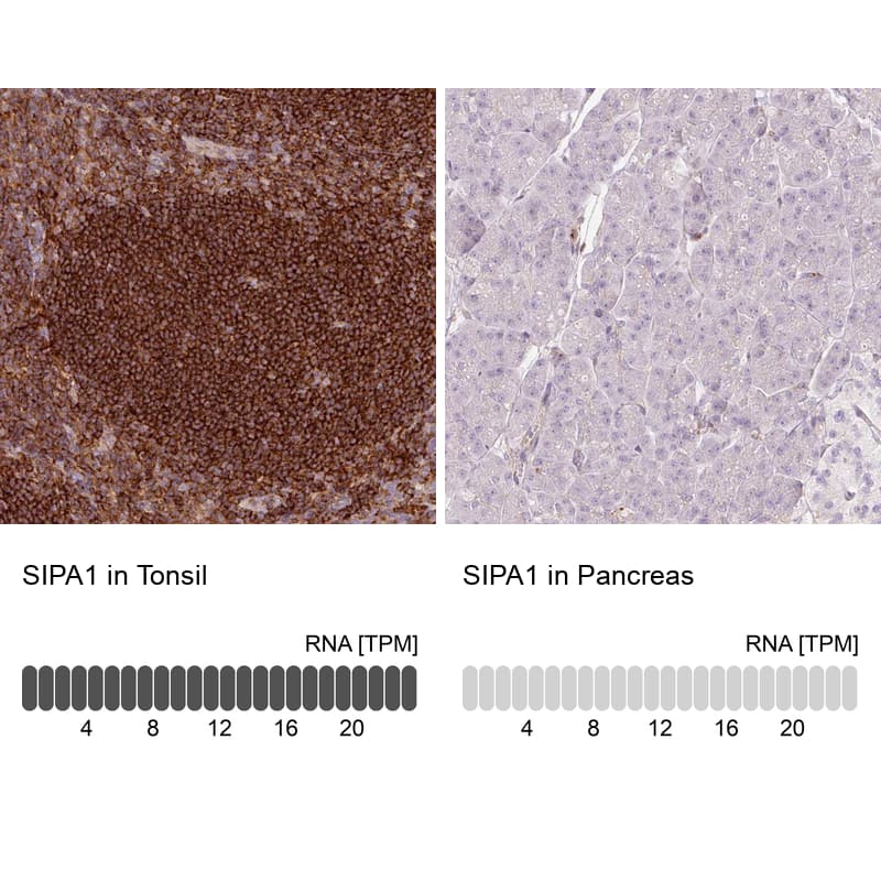 <b>Orthogonal Strategies Validation. </b>Analysis in human tonsil and pancreas tissues.