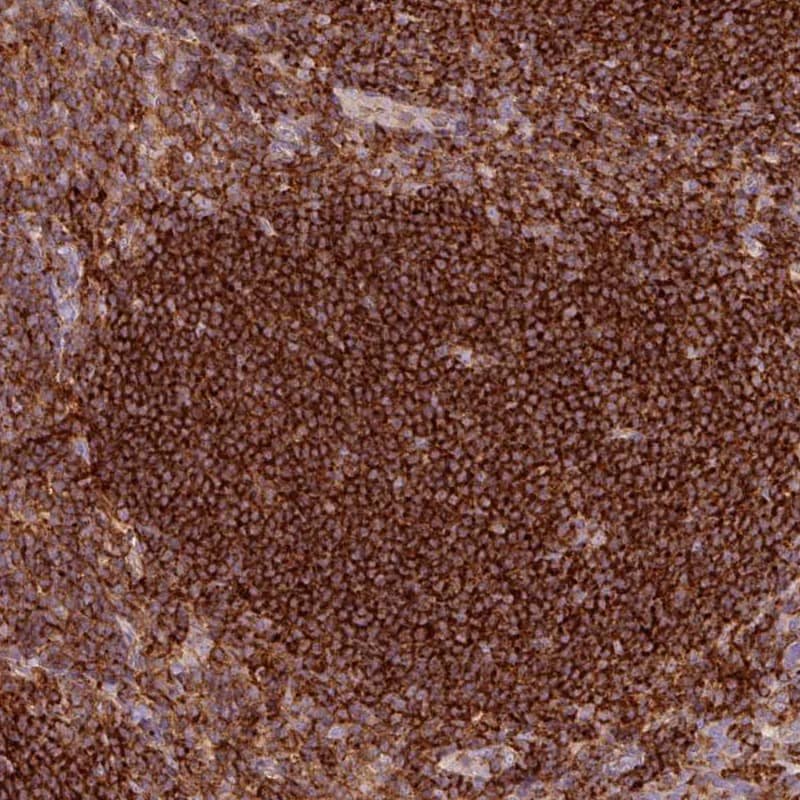 Staining of human tonsil shows high expression.