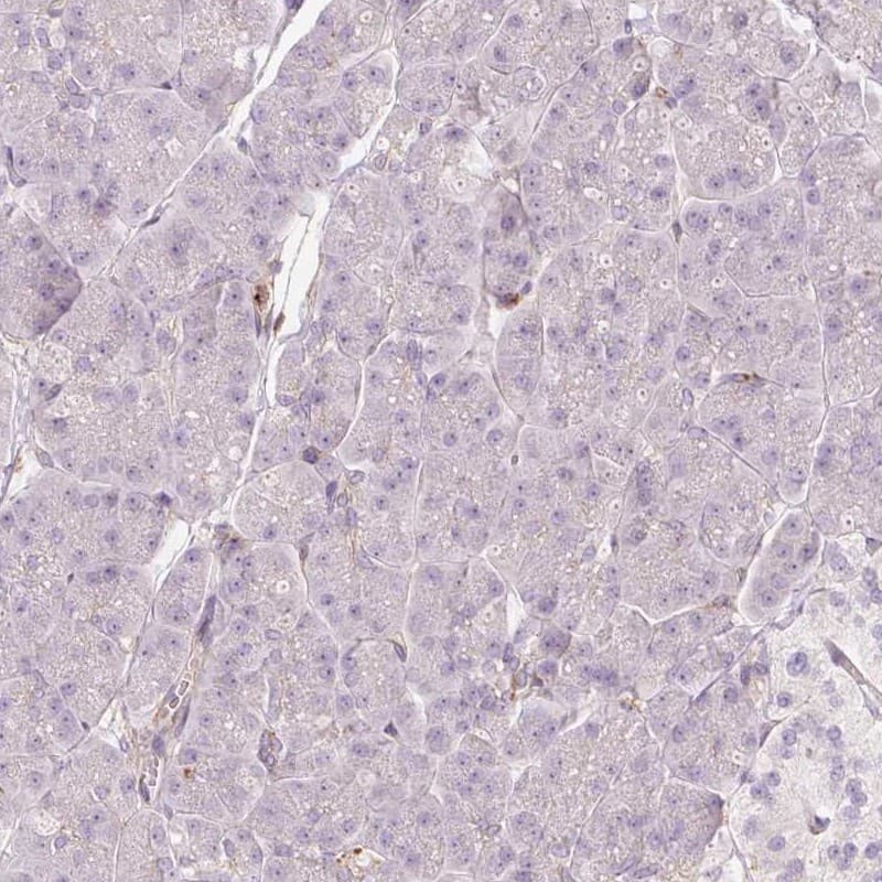 Staining of human pancreas shows low expression as expected.