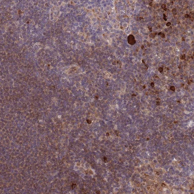 Staining of human lymph node shows high expression.
