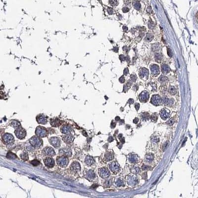 Immunohistochemistry-Paraffin CLPB Antibody - BSA Free