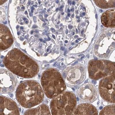Immunohistochemistry-Paraffin CLPB Antibody - BSA Free
