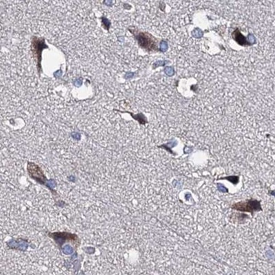 Staining of human cerebral cortex.