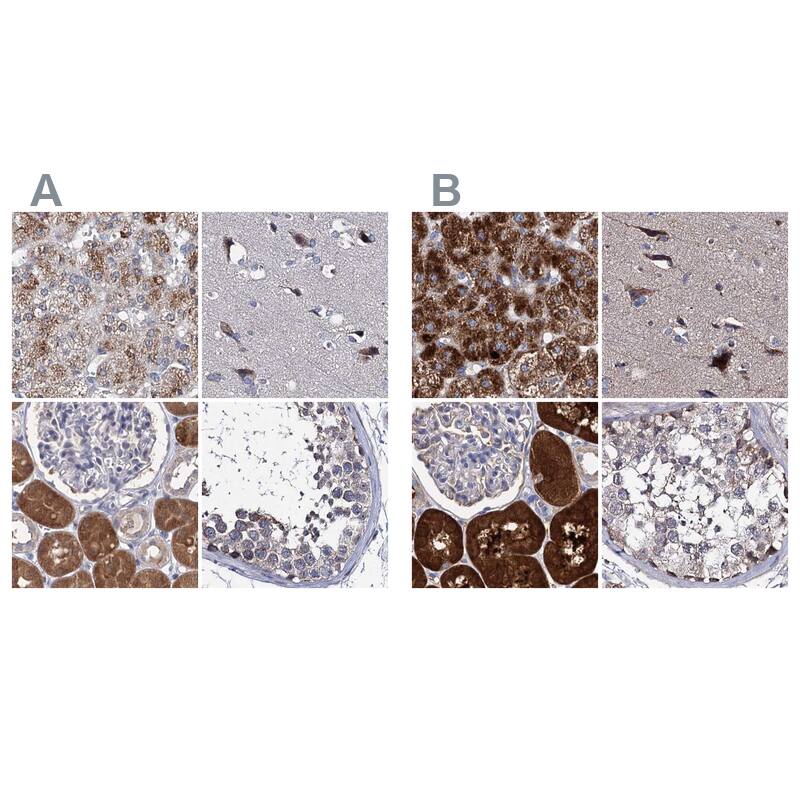 Staining of human adrenal gland, cerebral cortex, kidney and testis HPA039005 (A) shows similar protein distribution across tissues to independent antibody HPA039006 (B).