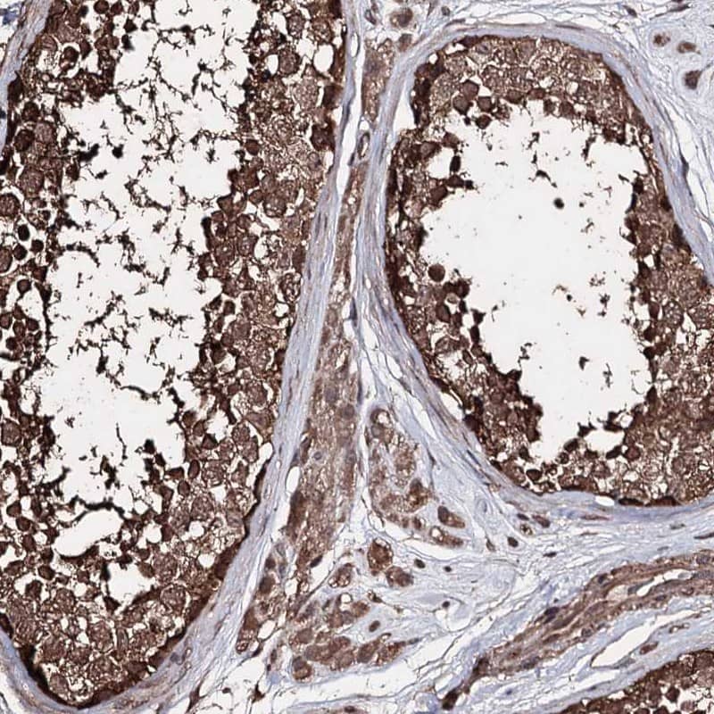 Staining of human testis shows cytoplasmic positivity in cells in seminiferous ducts and Leydig cells.