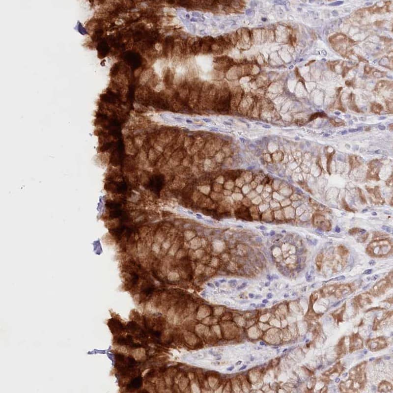 Staining of human stomach, lower shows strong cytoplasmic positivity in glandular cells.