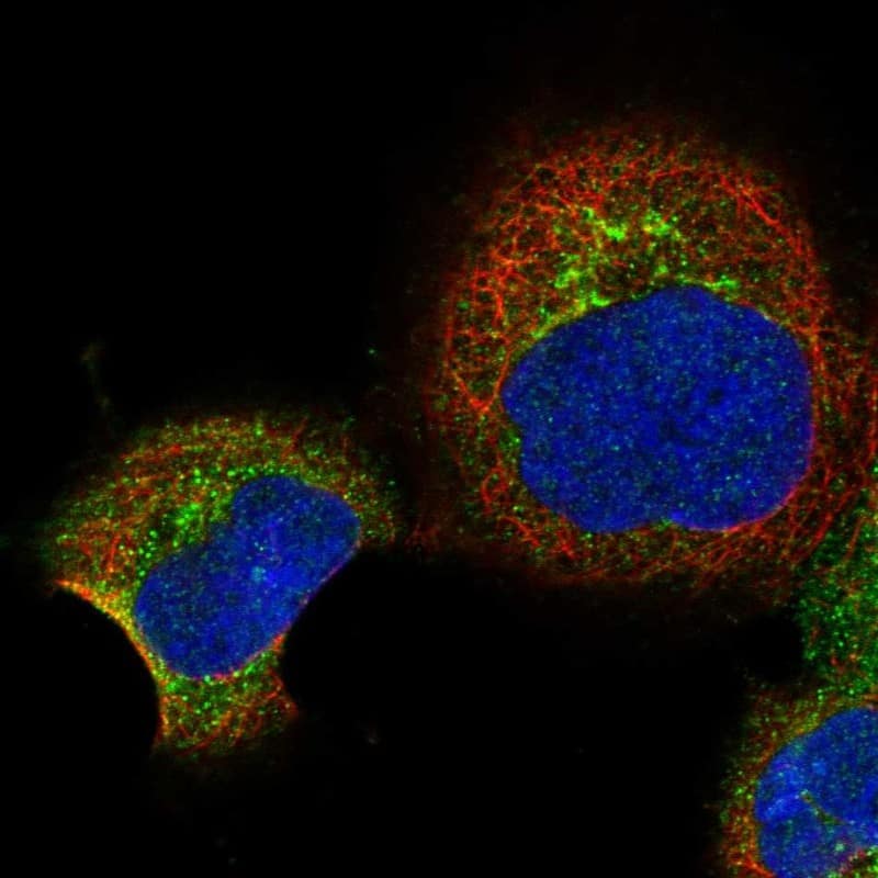 Staining of human cell line A-431 shows localization to the Golgi apparatus & vesicles.