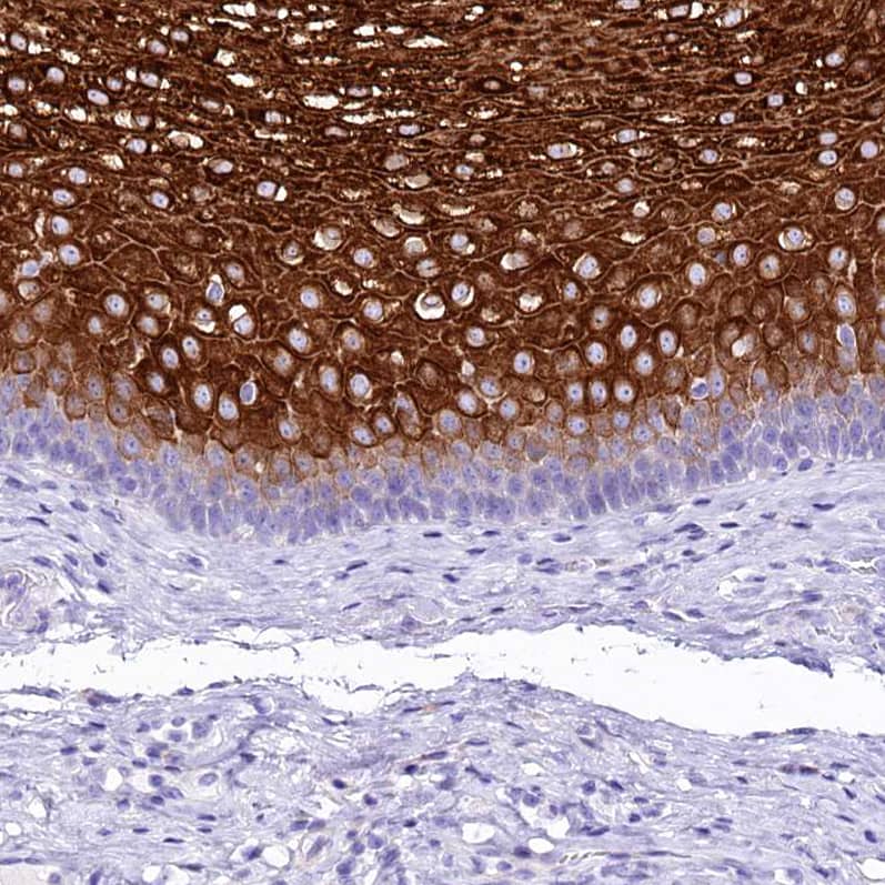 Staining of human esophagus shows strong cytoplasmic/membranous positivity in squamous epithelial cells.