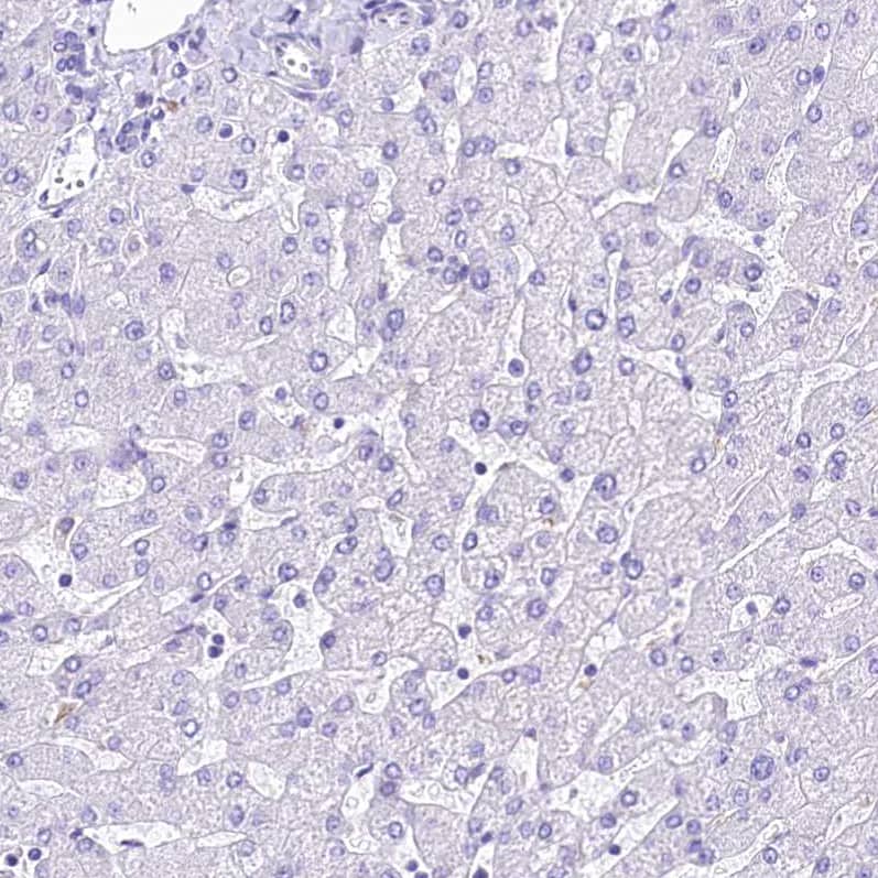 Staining of human liver shows no positivity in hepatocytes as expected.