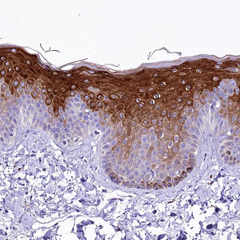 Staining of human skin shows strong cytoplasmic positivity in epidermal cells.