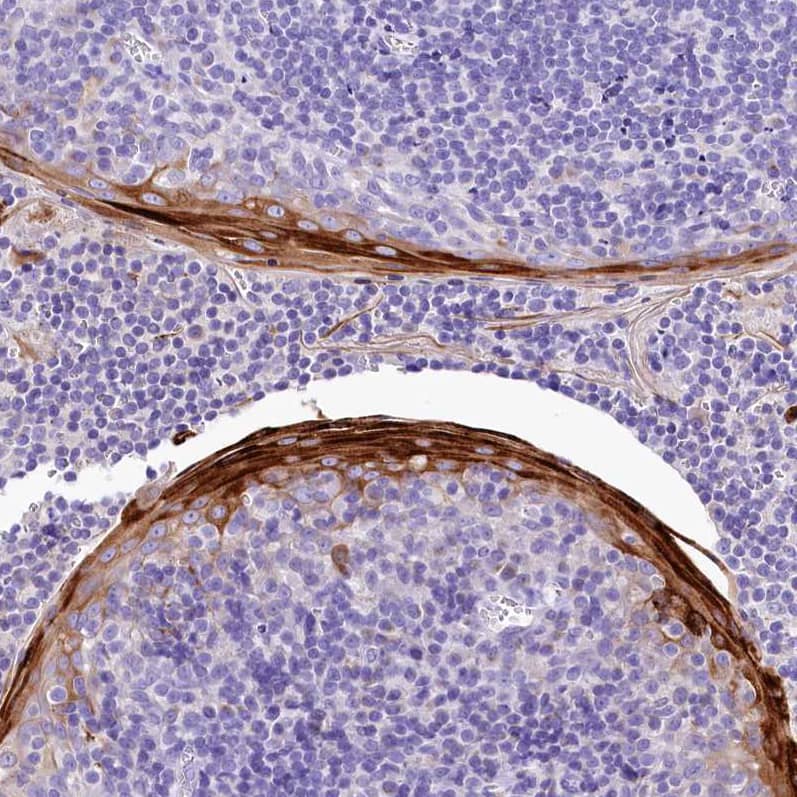 Staining of human tonsil shows strong cytoplasmic positivity in squamous epithelial cells.