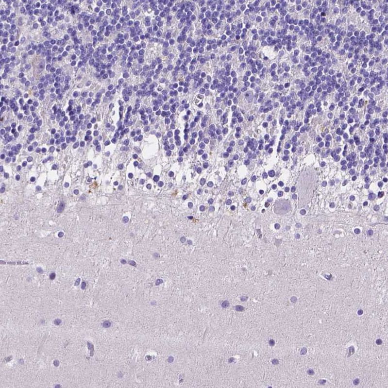 Staining of human cerebellum shows no positivity in Purkinje cells as expected.