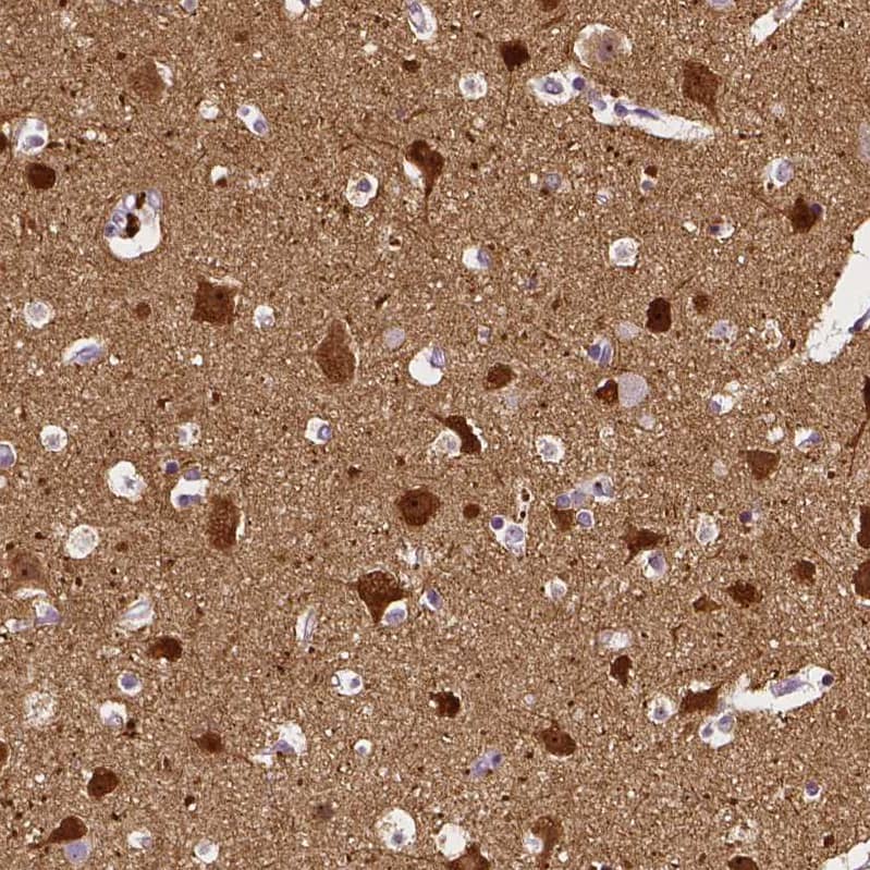 Staining of human cerebral cortex shows strong cytoplasmic positivity in neurons.