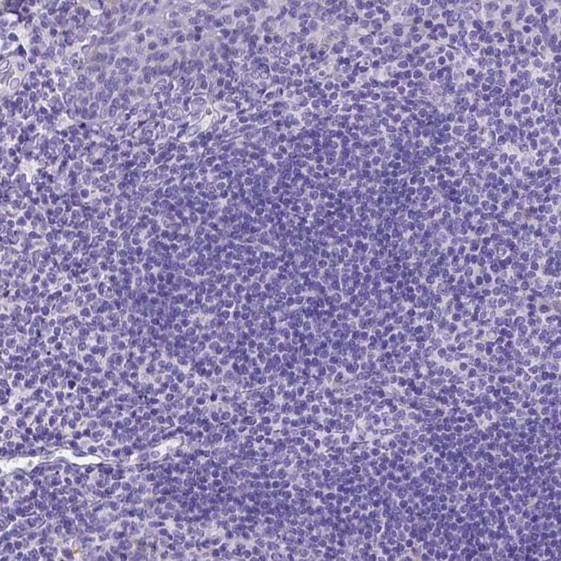 Staining of human lymphoid tissues shows no positivity in germinal center cells as expected.